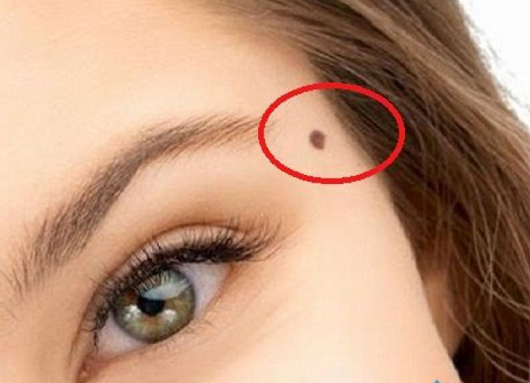 Nốt ruồi nằm ở đuôi mắt phụ nữ