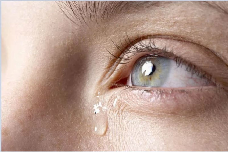 Nốt ruồi nằm ở sảnh nước mắt