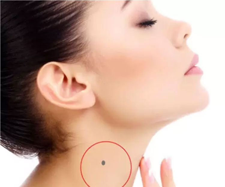 Nốt ruồi nằm ở cổ bên phải phụ nữ