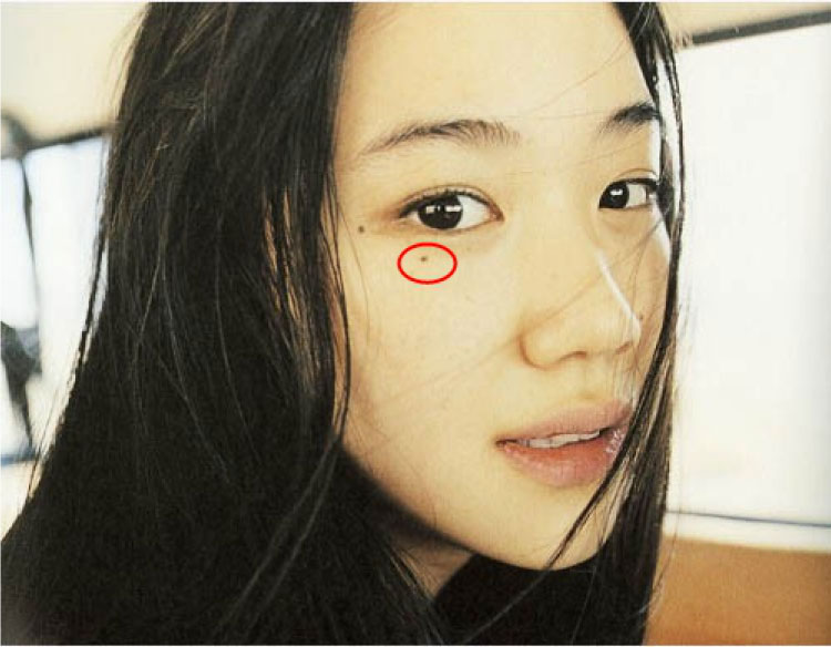 Nốt ruồi ở xung quanh mắt phụ nữ